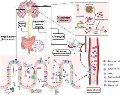 Gut microbiota metabolites: potential therapeutic targets for Alzheimer’s disease?